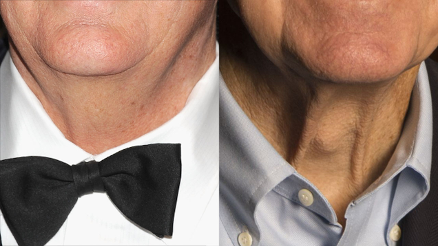 Illustration for article titled The Necks Of Wealth: Here Are 7 Billionaires’ Throats